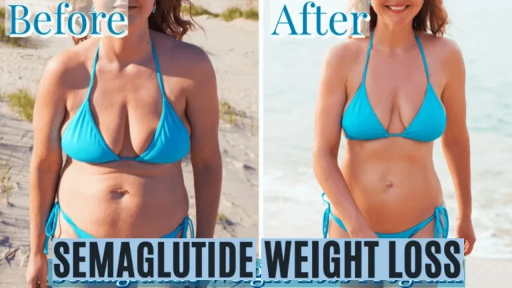 semaglutide weight loss