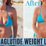 semaglutide weight loss