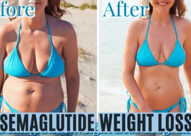 Thinking About Semaglutide for Weight Loss? Read This First!