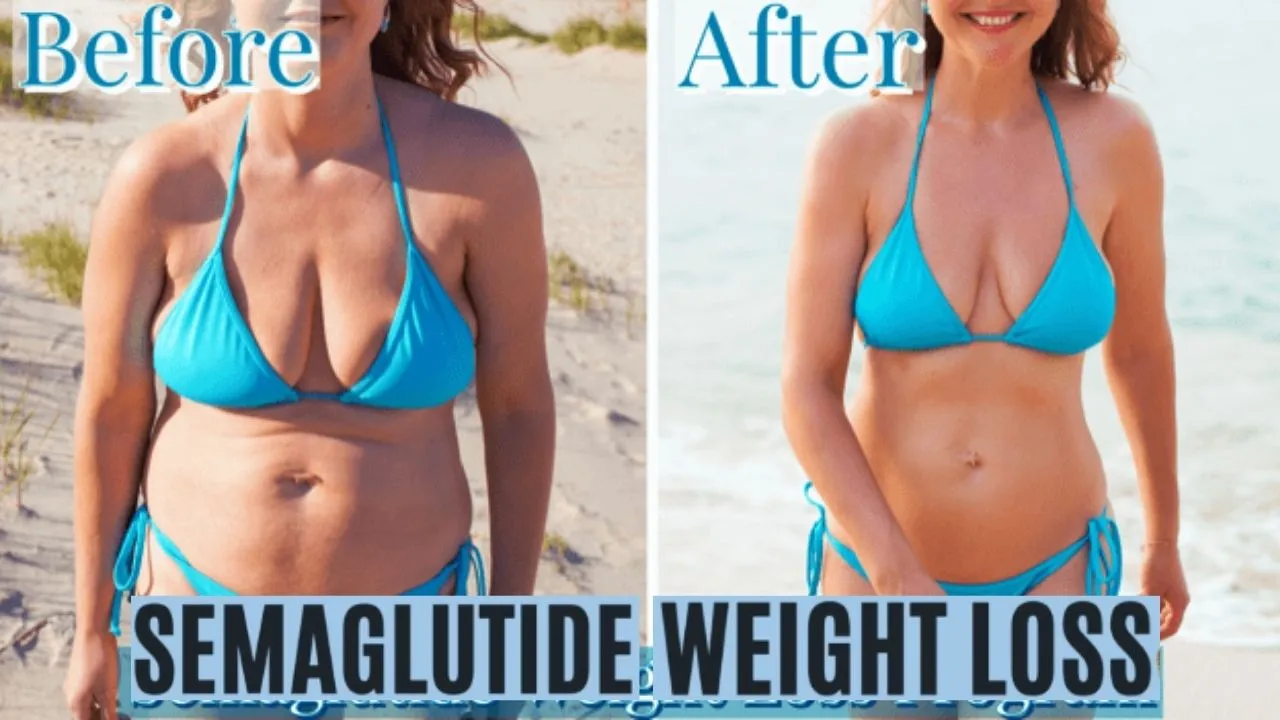 Thinking About Semaglutide for Weight Loss? Read This First!