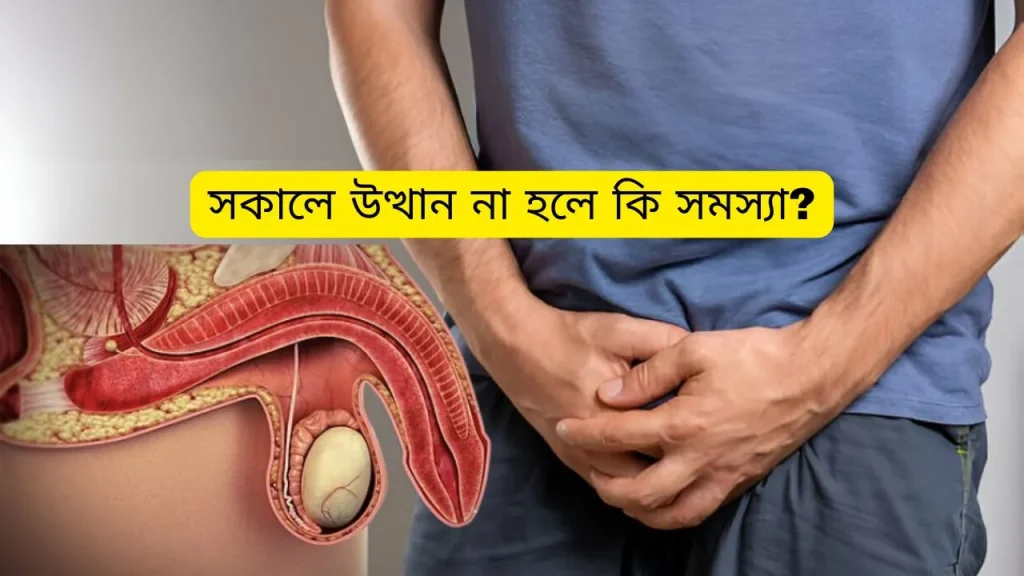 সকালে উত্থান না হলে কি সমস্যা